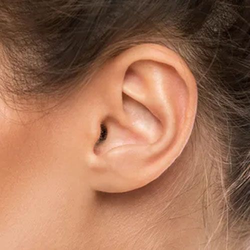 Ear Lobe Surgeries